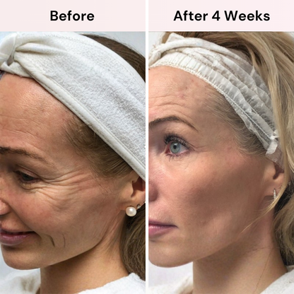 Koregene™ | PDRN Youth Revival Serum