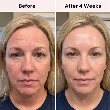 Koregene™ | PDRN Youth Revival Serum