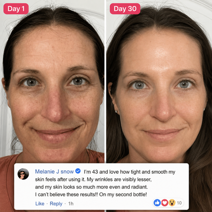 Koregene™ | PDRN Youth Revival Serum